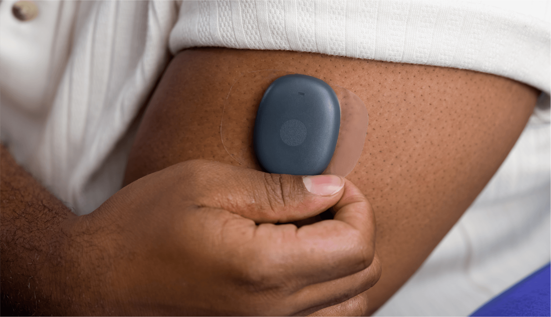 Eversense-anv&auml;ndare f&auml;ster en CGM-s&auml;ndare p&aring; sin &ouml;verarm, i en n&auml;rbild.