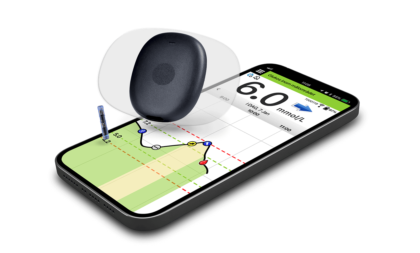 Eversense långtids-CGM-enhet svävar ovanför en smartphone som visar en glukosövervakningsapp