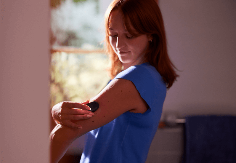 En ung kvinna klistrar på Eversense-sändaren på sin arm
