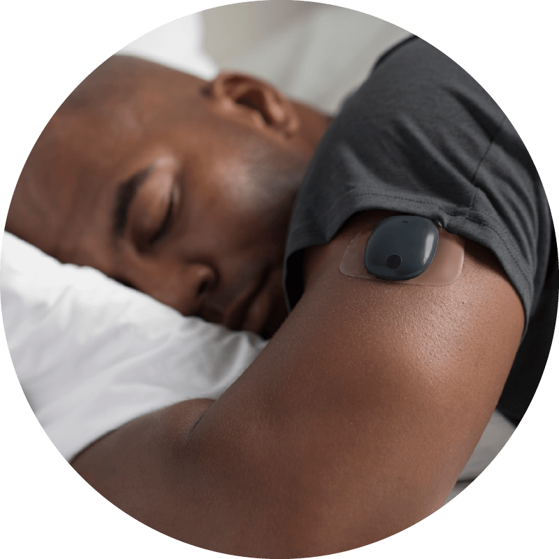 En person ligger och sover på en kudde och har en liten svart CGM-enhet på överarmen för glukosövervakning.