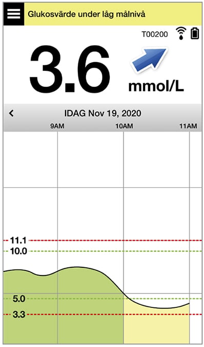 Glukosmätaren visar ”75 mg/dL” med ett diagram som visar nivåer under målområde
