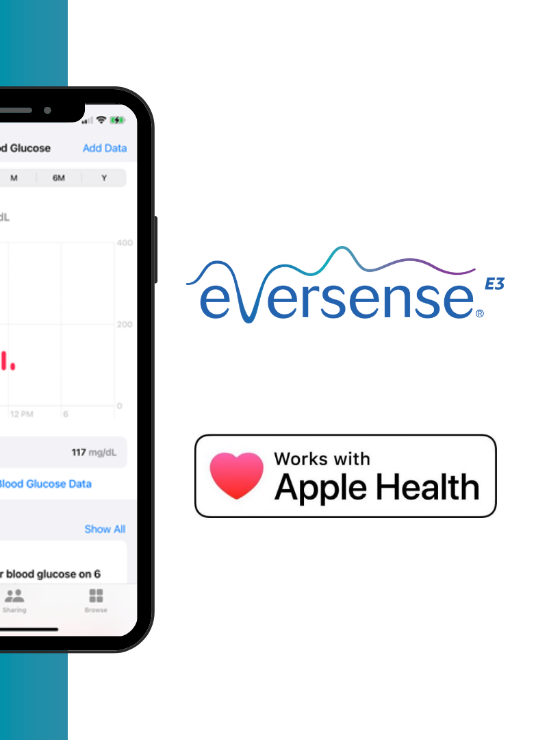 Smartphone som visar Eversense-appen som spårar glukosnivåer.